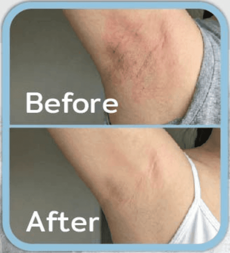 DUO Clean before and after results